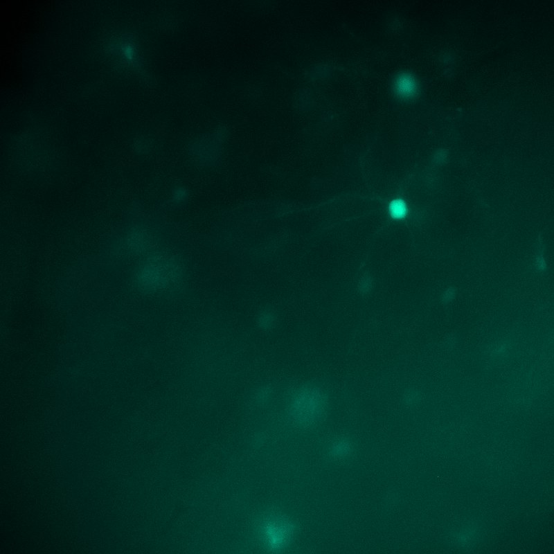 eGFP fluorescence patch clamp channel